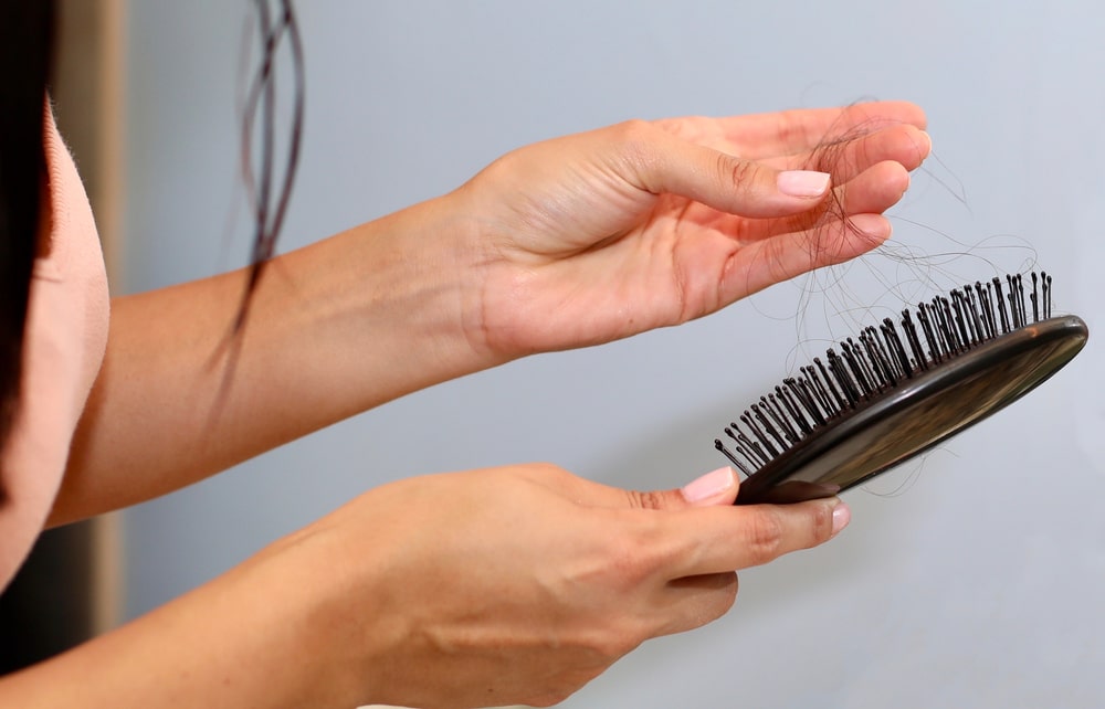 علل ریزش مو پس از زایمان
