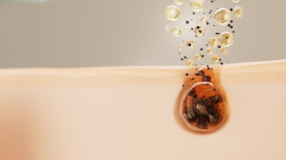 درمان جوش سرسیاه با ماسک طبیعی