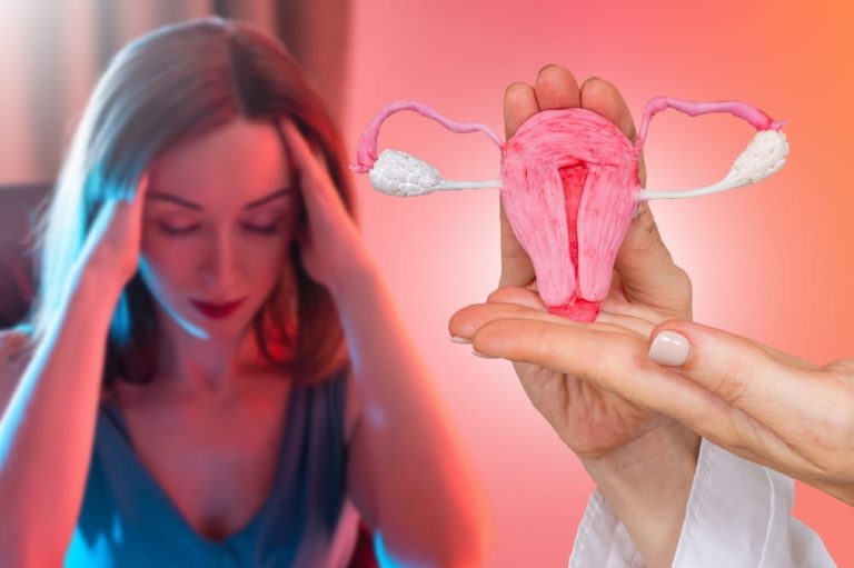 فرق تنبلی تخمدان خفیف و شدید | علائم و نحوه درمان هر کدام